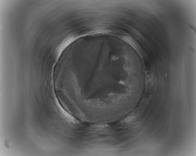 X0000099471055200805161106