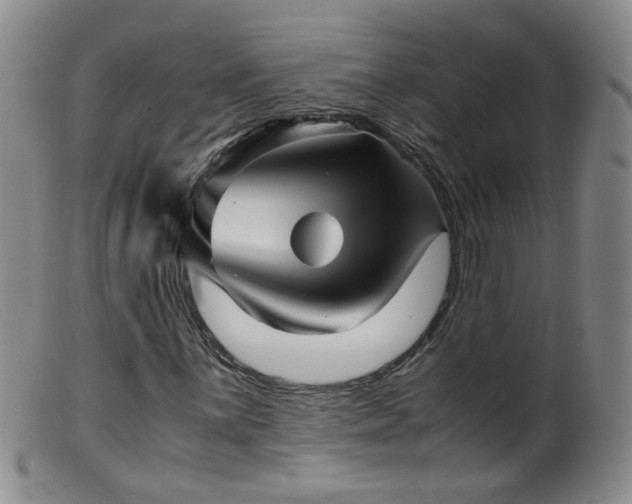 X0000099471059200805161105
