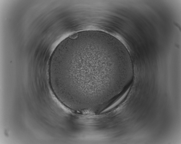 X0000099471142200805161105