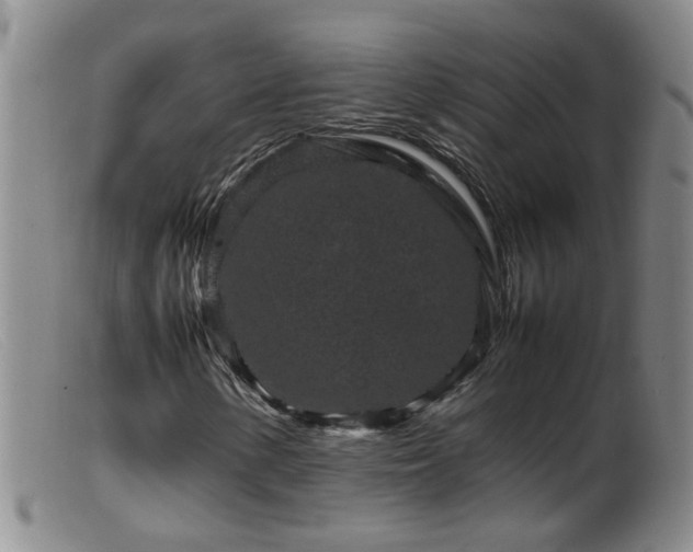 X0000099471154200805161104