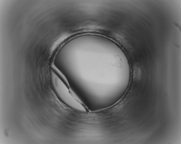 X0000099471164200805161104