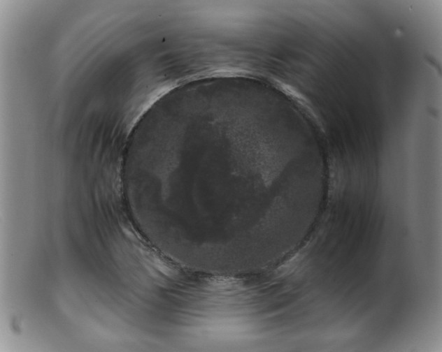 X0000099471170200805161104