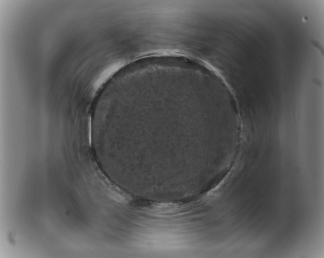 X0000099471171200805161104