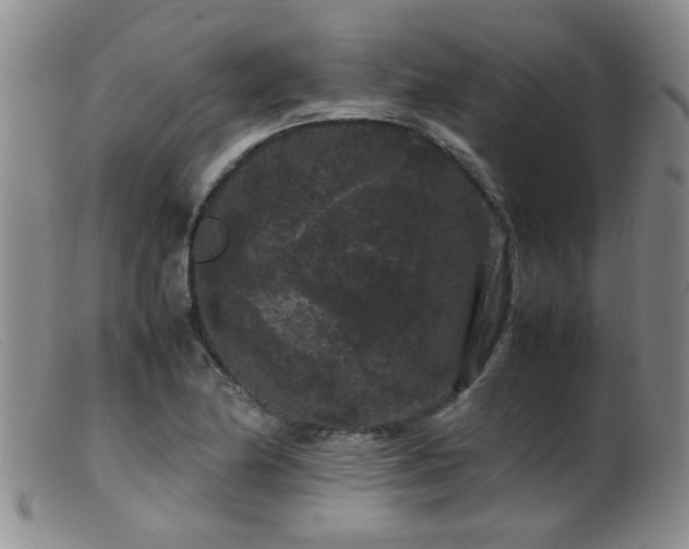 X0000099471174200805161104
