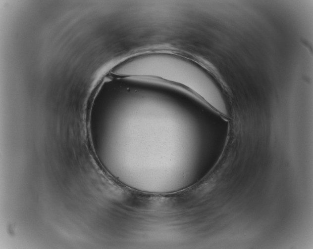X0000099471176200805161104