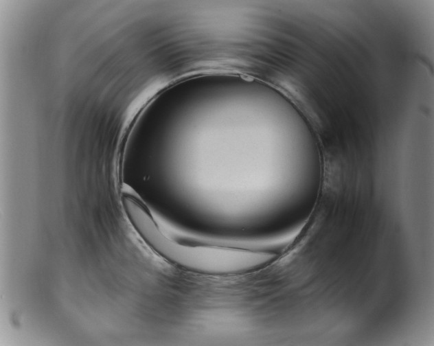 X0000099471196200805161103