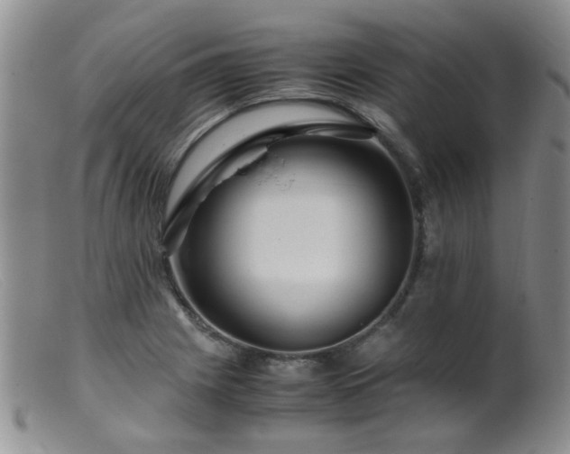 X0000099471225200805161103