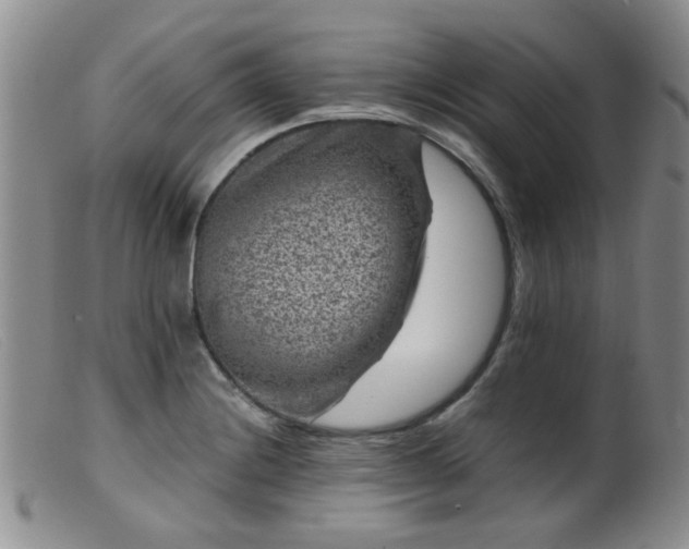 X0000099471228200805161103
