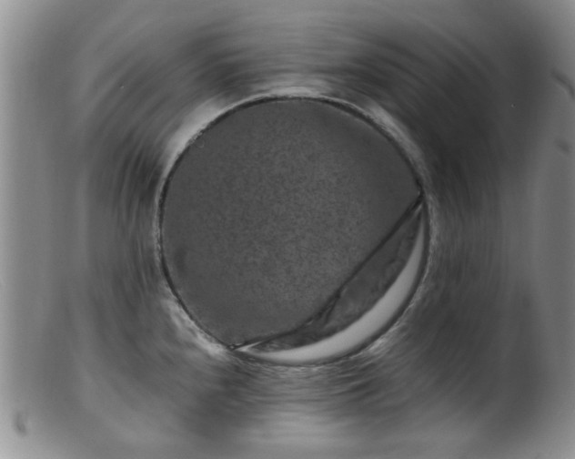 X0000099471240200805161103