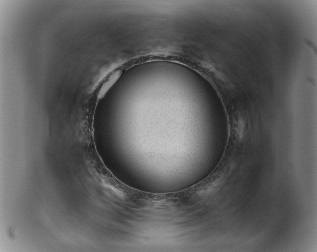X0000099471256200805161102