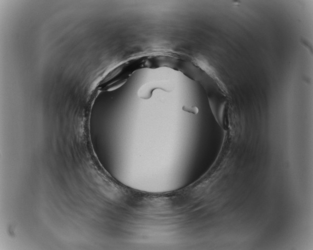 X0000099471260200805161102