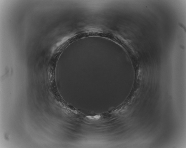 X0000099471303200805161101