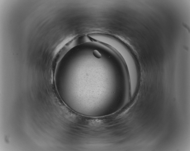 X0000099471317200805161101