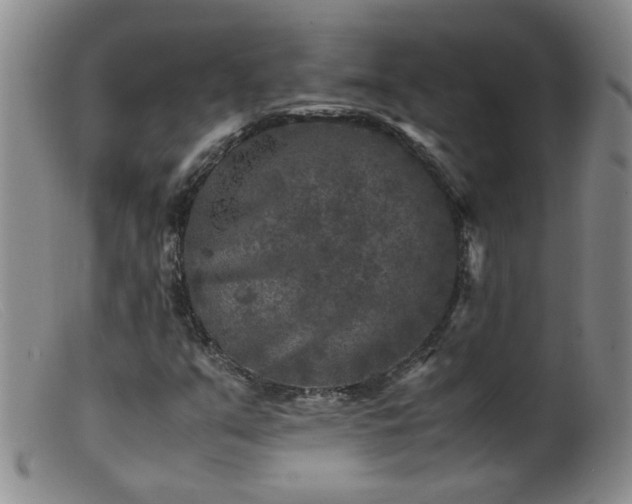 X0000099471351200805161101