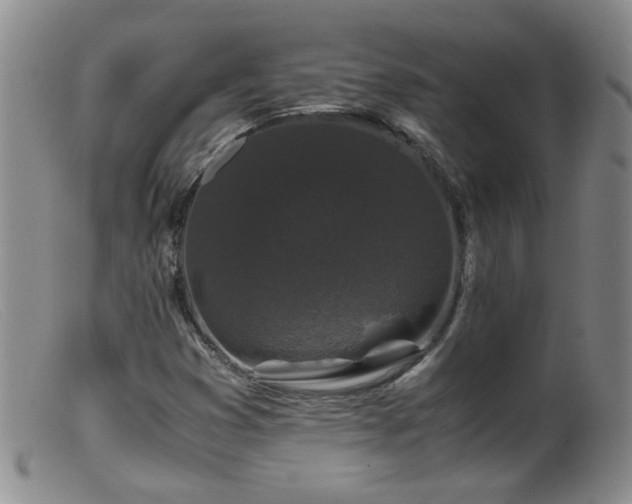 X0000099471353200805161101