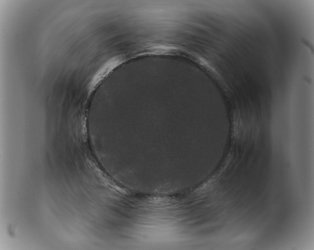 X0000099471362200805161101