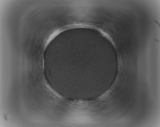 X0000099471365200805161101