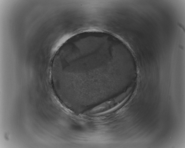 X0000099471367200805161101