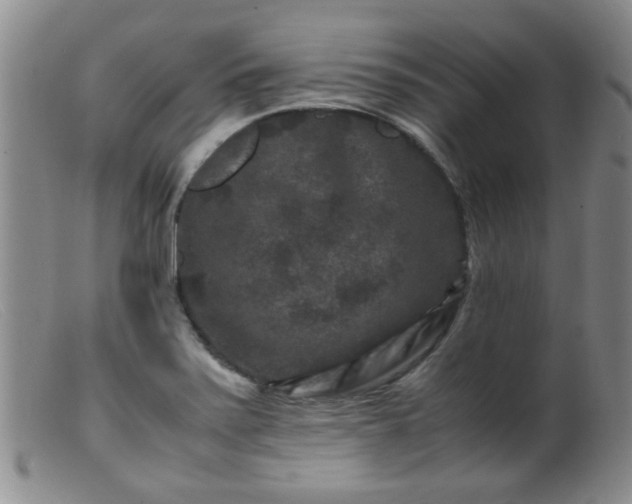 X0000099471371200805161101