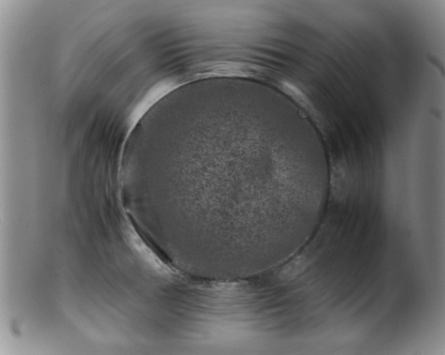 X0000099471378200805161101