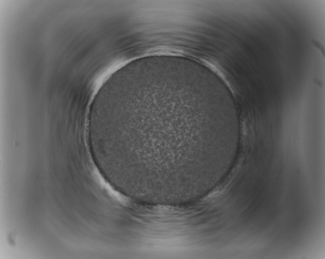 X0000099471379200805161101