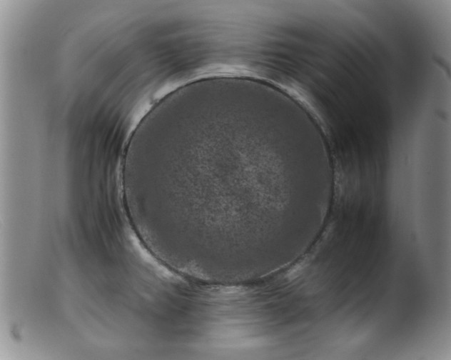 X0000099471382200805161100