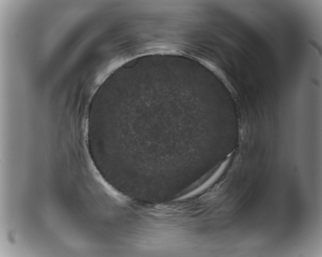 X0000099471383200805161100
