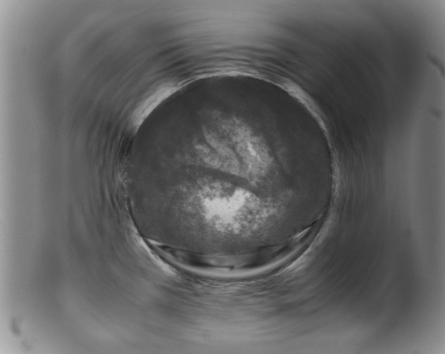 X0000099471385200805161100