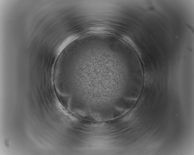 X0000099471386200805161100