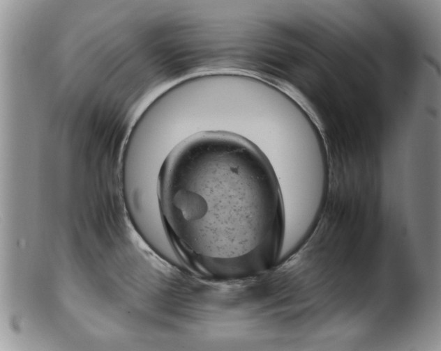 X0000099471388200805161100