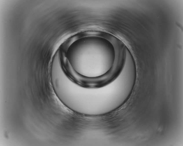 X0000099471392200805161100