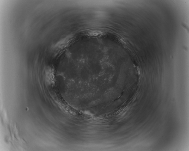 X0000099471394200805161100