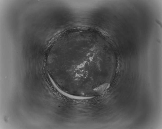 X0000099471397200805161100