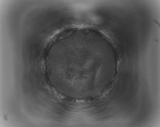 X0000099471398200805161100