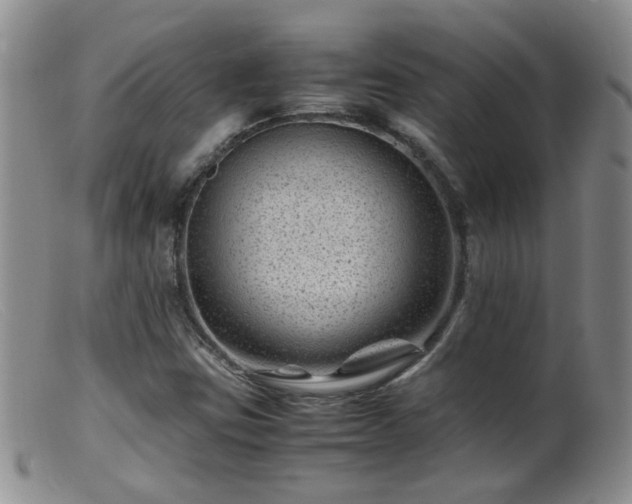 X0000099471403200805161100