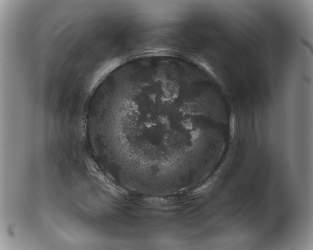 X0000099471405200805161100