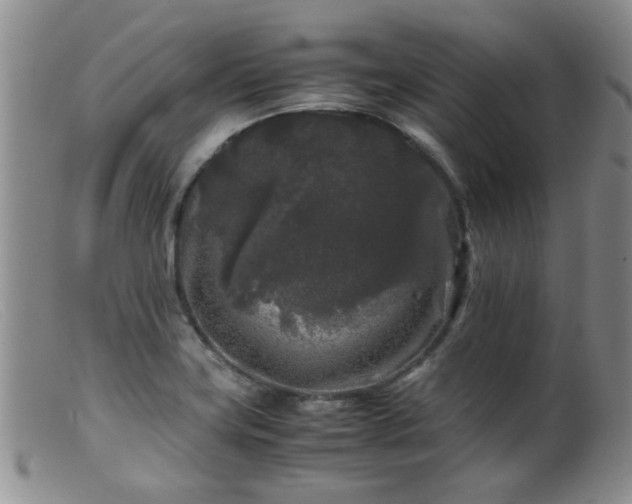 X0000099471419200805161100
