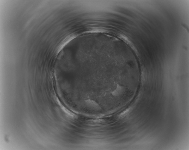 X0000099471425200805161100