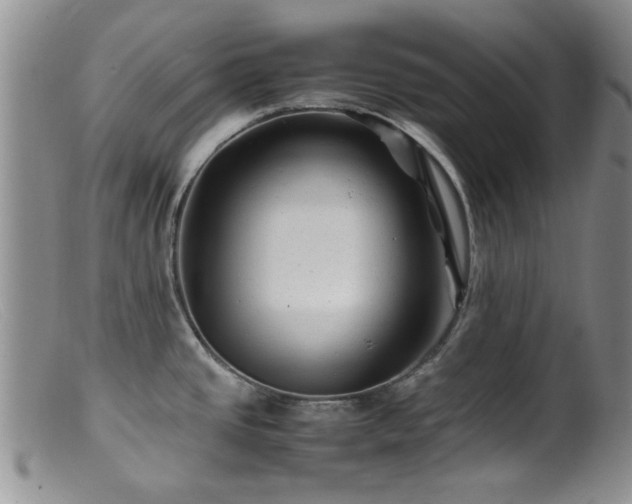 X0000099471437200805161100