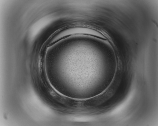 X0000099471438200805161100