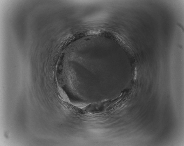 X0000099471441200805161100