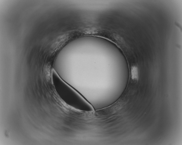 X0000099471444200805161100