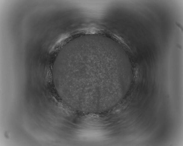 X0000099471446200805161100