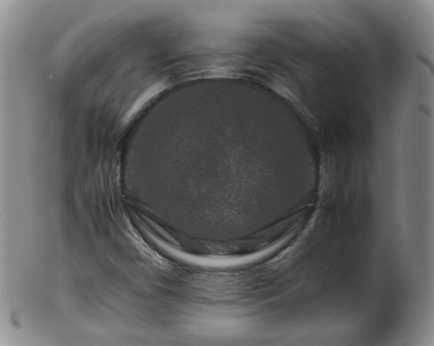 X0000099471450200805161100
