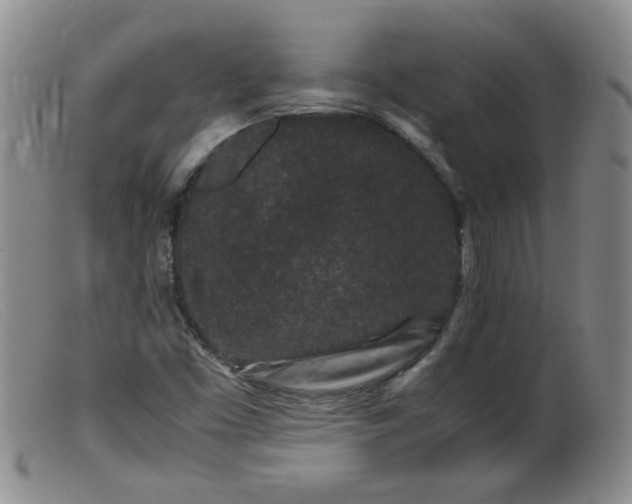 X0000099471453200805161059
