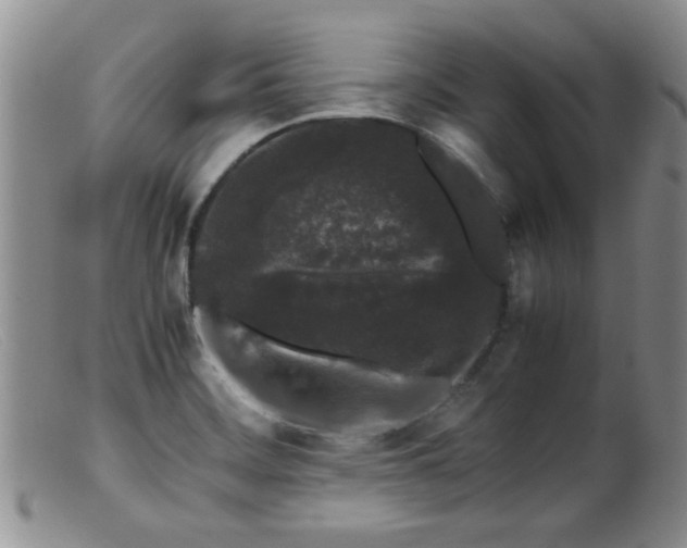 X0000099471468200805161059