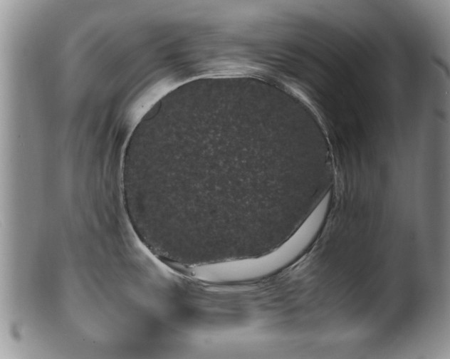 X0000099471487200805161059