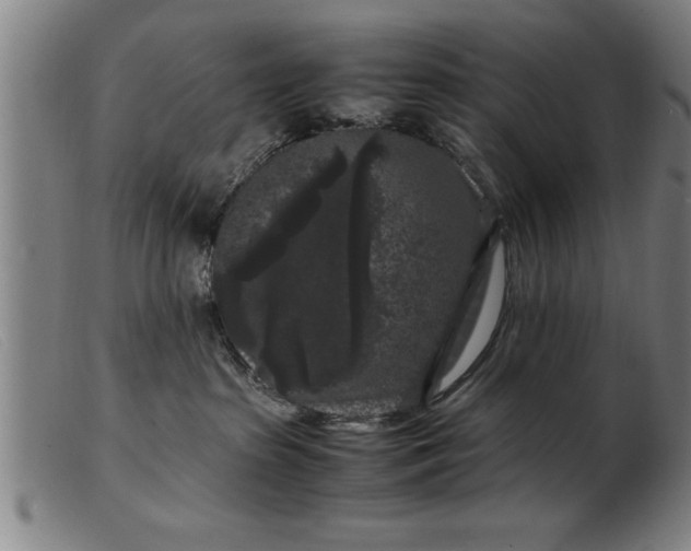 X0000099470285200805231838