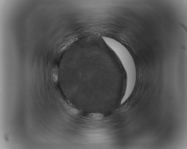 X0000099470719200805231830