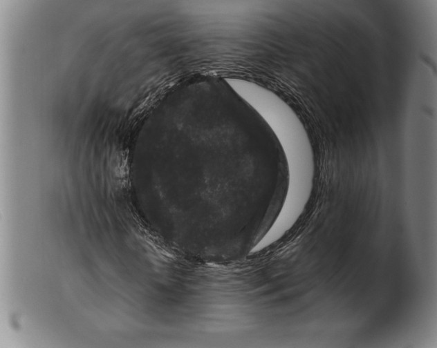 X0000099470818200805231828
